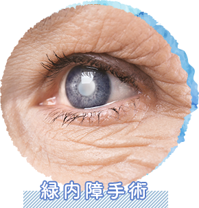 緑内障手術